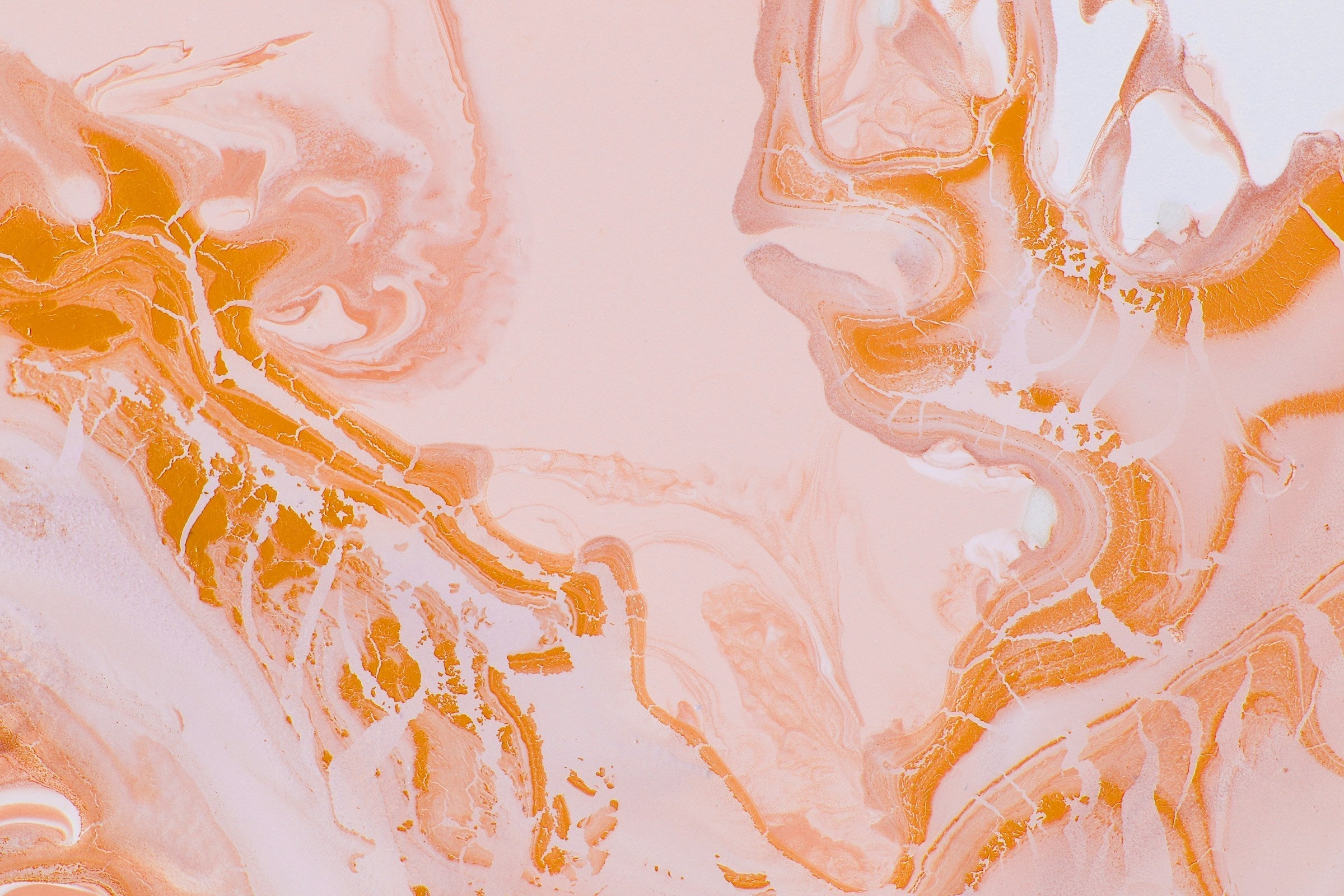 Irritable Bowel Syndrome (IBS): Symptoms, Causes, Types & More